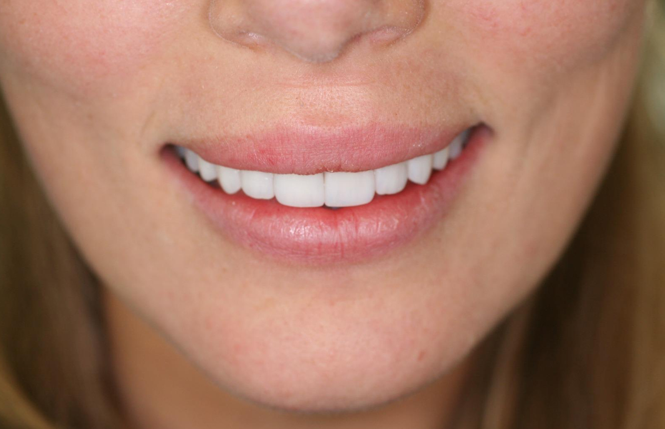 img1